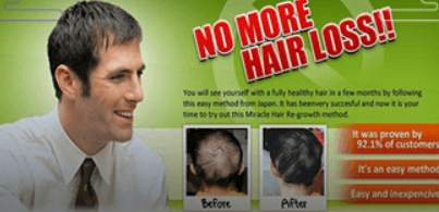 Japanese Miracle hair regrowth manual Do it Yourself 2 Min a Day